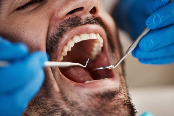 Best Root Canal Emergency Dentist  in Halsey, OR